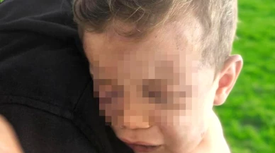 2 Yaşındaki Aren Bebek: Annesinin Arkadaşı Tarafından İşkence İddiası