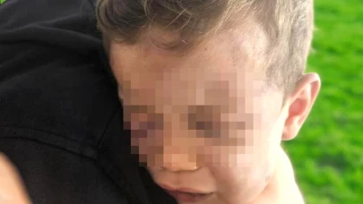 2 Yaşındaki Aren Bebek: Annesinin Arkadaşı Tarafından İşkence İddiası